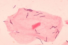 Lactobacillus_sp-1