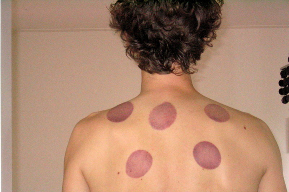 Cupping_results